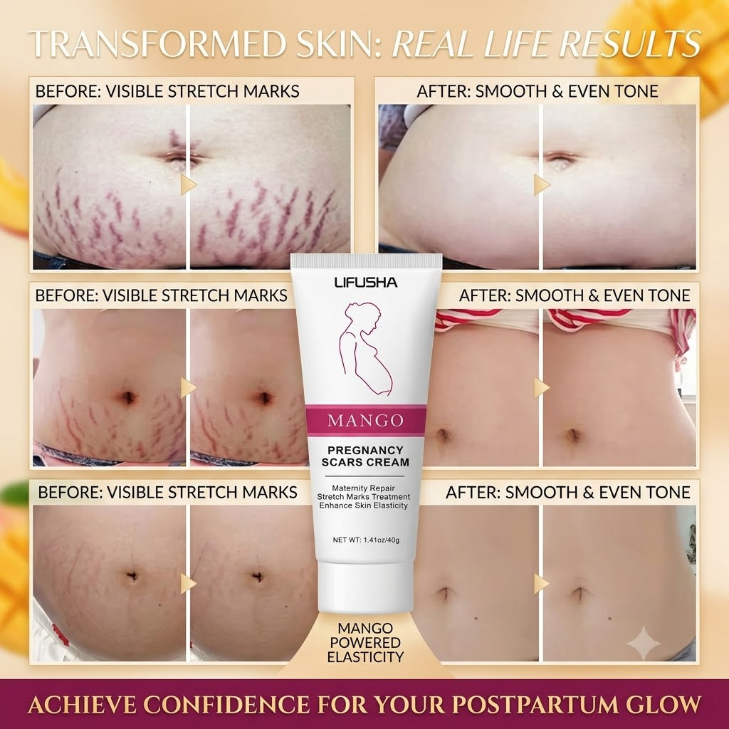 Stretch Mark Care & Moisturizing Cream for Pregnancy & Postpartum Skin