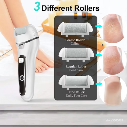 Automatic Dual-Sided Electric Foot Grinder – Rechargeable Pedicure & Callus Remover